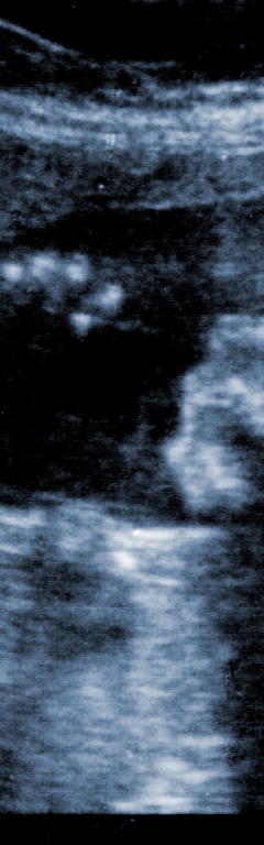 How Ultrasounds Save Lives: The Science Behind the First Look at Life