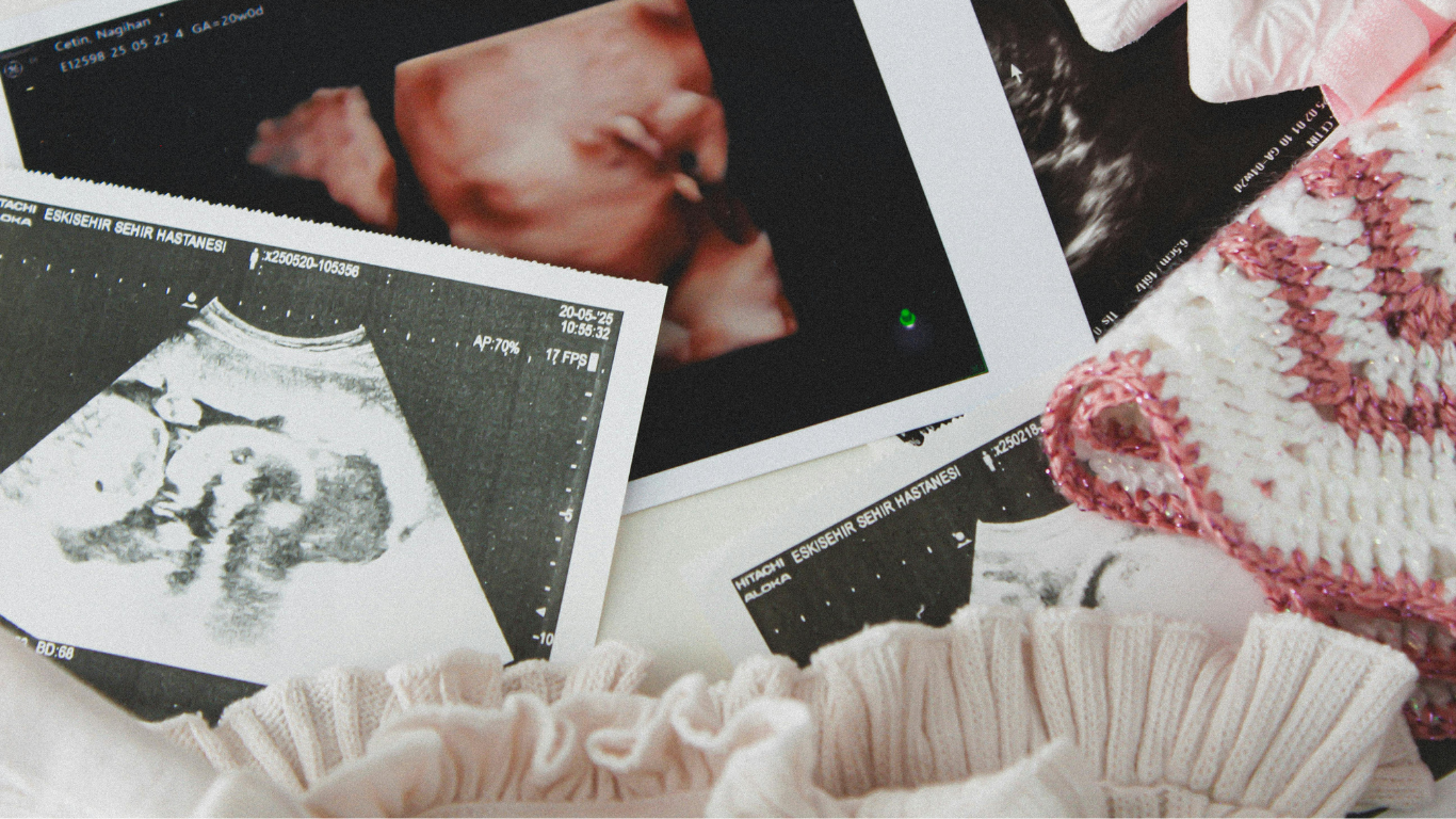 Seeing is Believing: Why Ultrasound Awareness Month Matters More Than Ever
